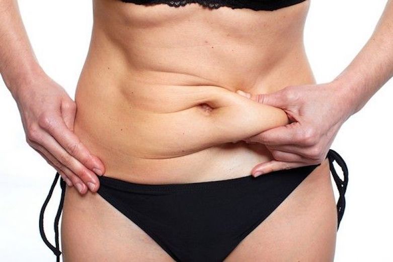 Silhouette après chirurgie abdominale